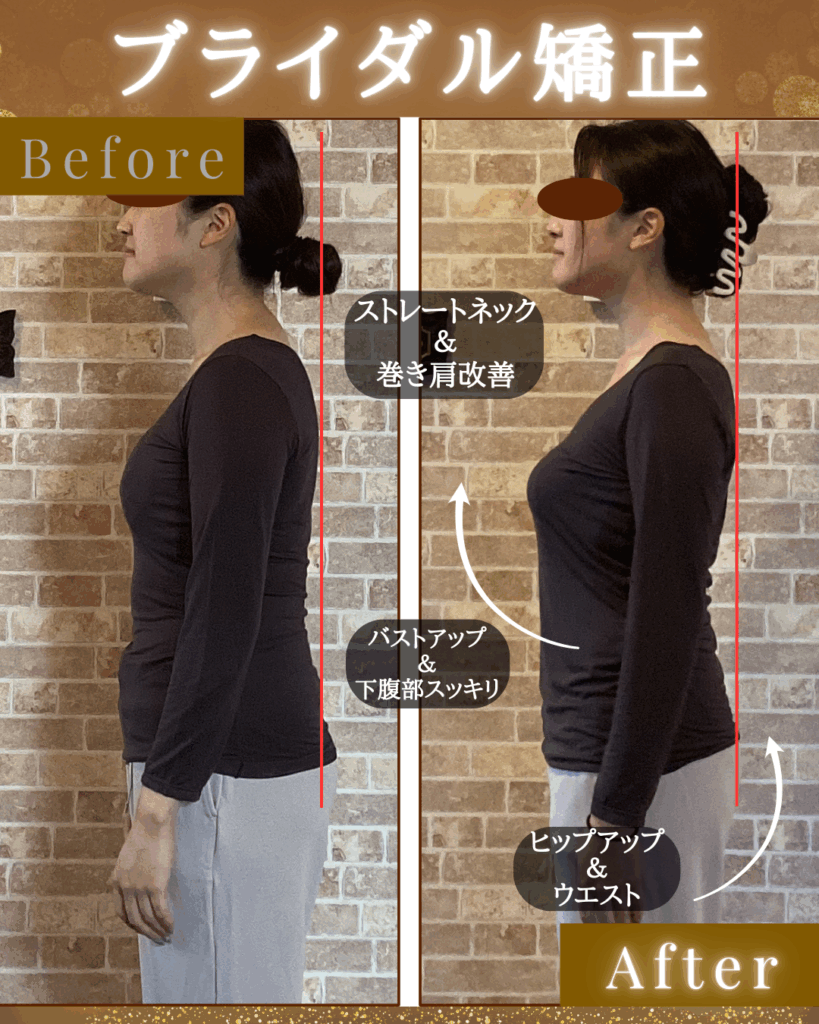 富士市整体｜リバース｜ビフォーアフター｜ブライダル矯正｜小入れて顔矯正｜姿勢矯正｜ダイエット｜横向き｜横向き｜ストレートネック改善｜巻き肩改善｜ヒップアップ｜バストアップ