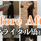 富士市整体｜ビフォーアフター｜美容矯正サロンリバース｜ブライダル矯正｜見た目が変わる！ブライダル矯正で叶える自分史上最高の姿