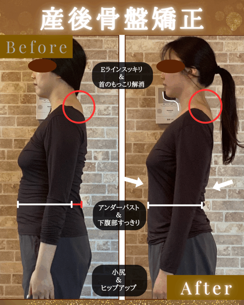 富士市整体｜リバース｜ビフォーアフター｜30代前半｜産後のメンテ｜ダイエット｜16時間ダイエット｜