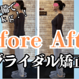 富士市整体｜リバース｜ビフォーアフター｜ブライダル矯正｜小顔矯正｜７kgダイエット