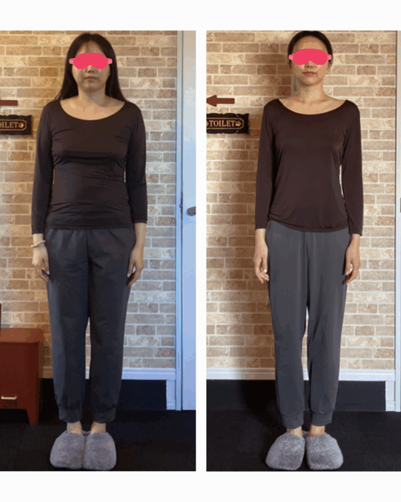 富士市整体｜リバース｜ビフォーアフター｜30代前半｜産後ダイエット｜16時間ダイエット｜マイナス14.5kg｜正面