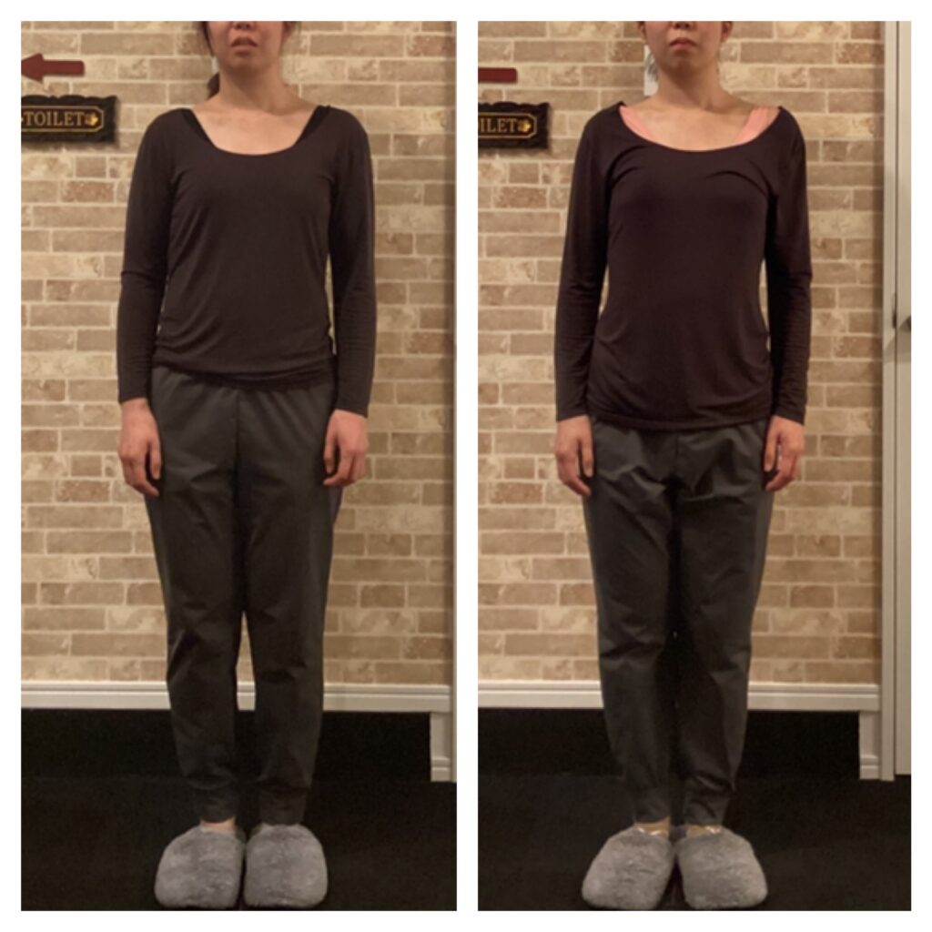 
富士市整体｜美容矯正サロンリバース｜ブログ｜ビフォーアフター｜姿勢矯正｜30代前半｜正面｜メニエール改善｜頭痛改善｜腰痛改善