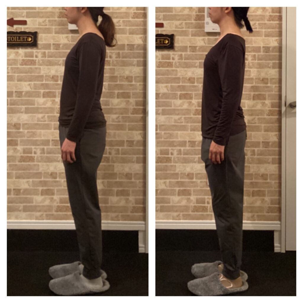 富士市整体｜美容矯正サロンリバース｜ブログ｜ビフォーアフター｜姿勢矯正｜30代前半｜横向き｜メニエール改善｜頭痛改善｜腰痛改善