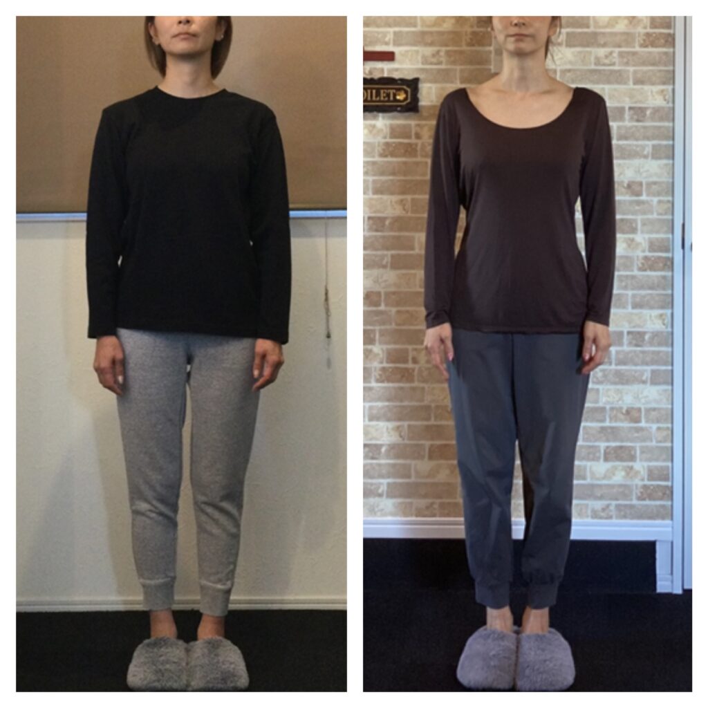 富士市整体｜美容矯正｜リバース｜ビフォーアフター｜ブログ｜４０代｜アンチエイジング｜正面