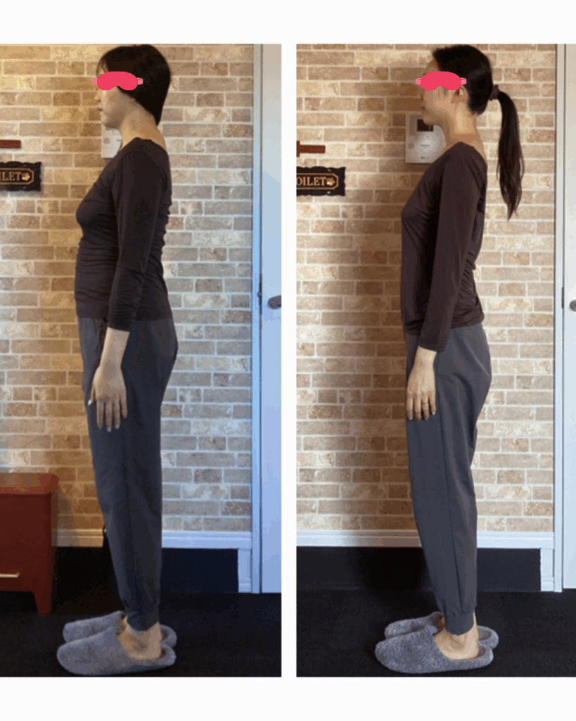 富士市整体｜リバース｜ビフォーアフター｜30代前半｜産後のメンテ｜ダイエット｜16時間ダイエット｜