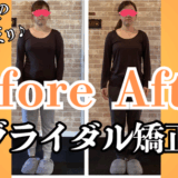 富士市整体｜リバース｜ビフォーアフター｜ブライダル矯正｜姿勢改善｜姿勢矯正｜ブログ