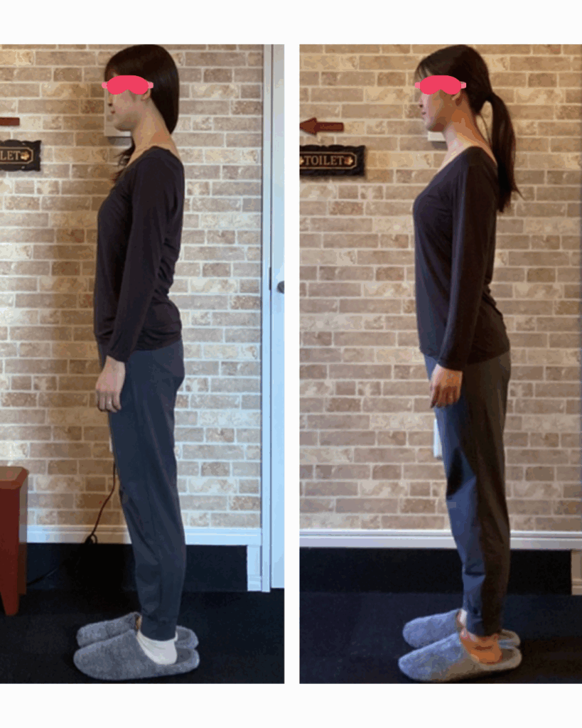 富士市整体｜美容矯正サロンリバース｜姿勢矯正｜ビフォーアフター｜ブログ｜ブライダル矯正｜横向き