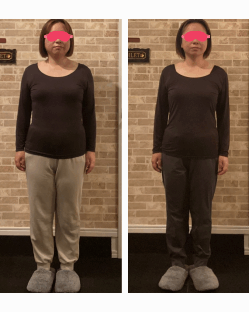 富士市整体｜美容矯正サロンリバース｜姿勢矯正｜ビフォーアフター｜ブログ｜7キロのダイエットに成功｜正面