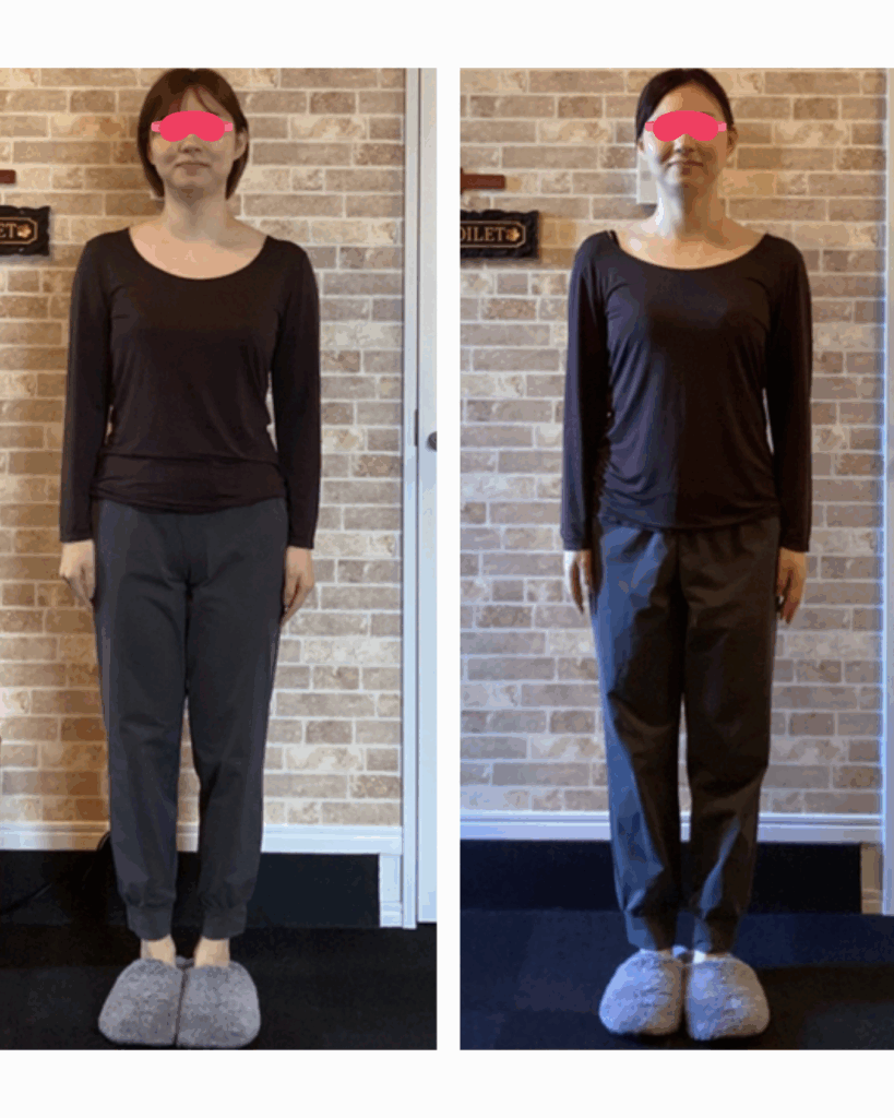 富士市整体｜富士市小顔矯正｜富士市姿勢矯正｜プロポーション矯正｜ダイエット｜ビフォーアフター｜ブログ｜疲労回復｜即効性｜ストレートネック改善｜正面