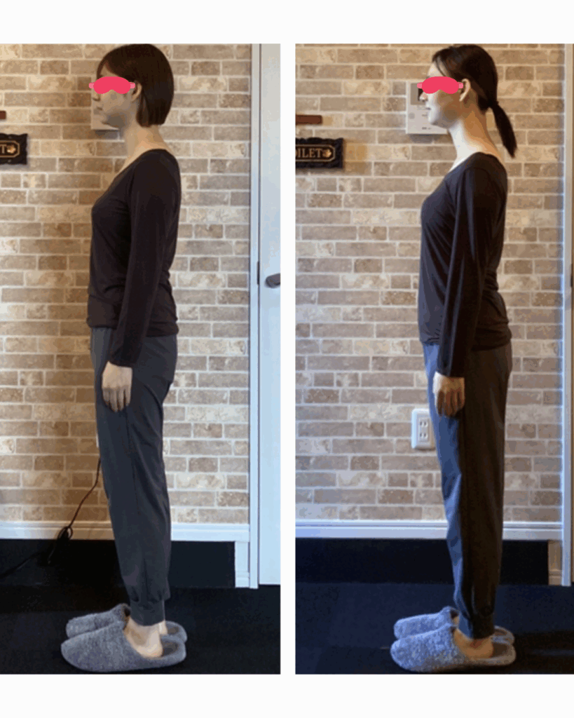 富士市整体｜富士市小顔矯正｜富士市姿勢矯正｜プロポーション矯正｜ダイエット｜ビフォーアフター｜ブログ｜疲労回復｜即効性｜ストレートネック改善｜横向き