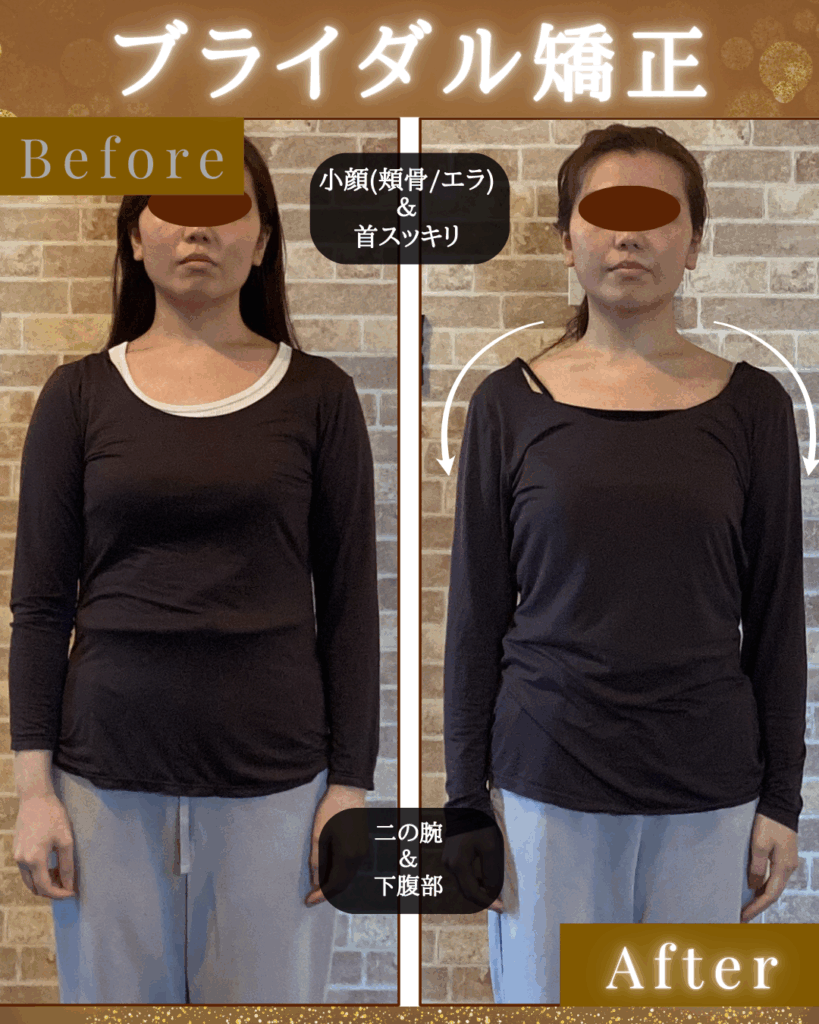 富士市整体｜美容矯正サロンリバース｜骨盤矯正｜小顔矯正｜ビフォーアフター｜ブログ｜ブライダル矯正｜巻き肩｜姿勢矯正｜正面