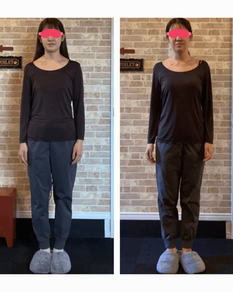 富士市整体｜美容矯正サロンリバース｜姿勢矯正｜ビフォーアフター｜ブログ｜ブライダル矯正｜書面