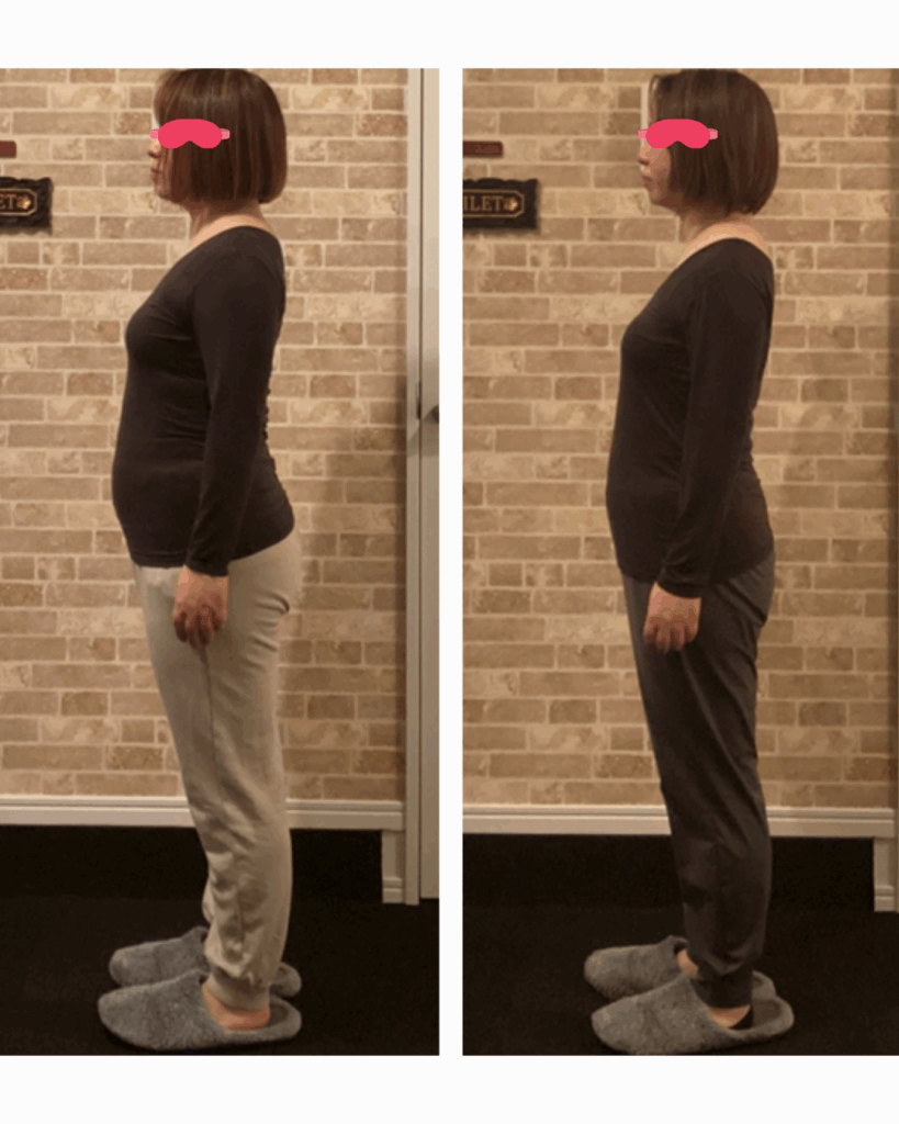 富士市整体｜美容矯正サロンリバース｜姿勢矯正｜ビフォーアフター｜ブログ｜7キロのダイエットに成功｜横向き