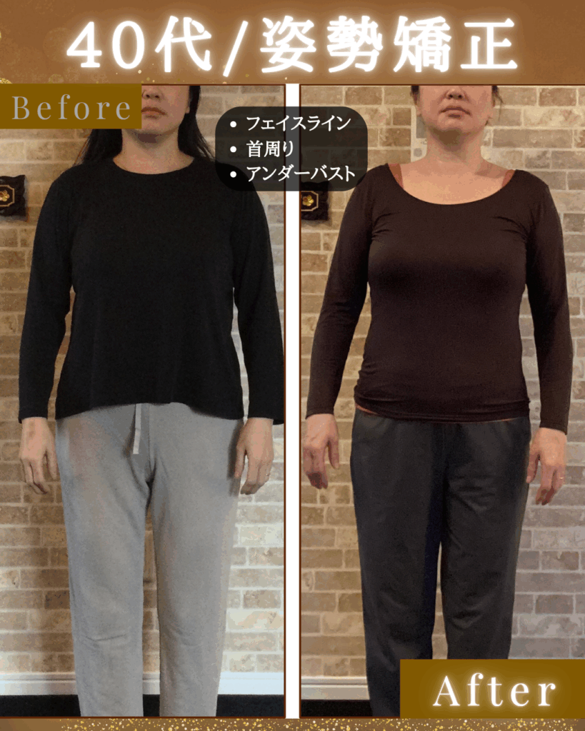 富士市の整体、美容矯正サロンRe・birthのブログ｜４０代女性の姿勢矯正｜ビフォーアフター｜正面