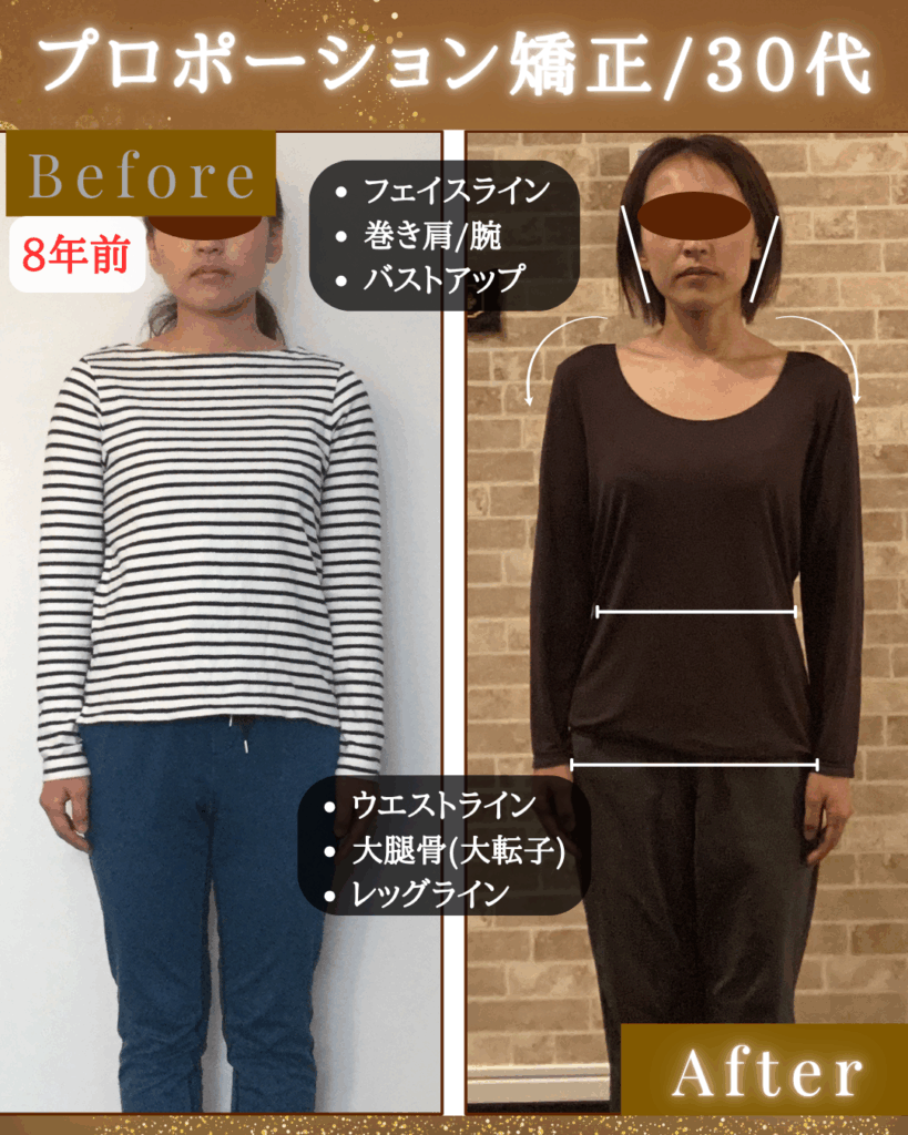 富士市整体｜富士市リバース｜富士市小顔矯正｜富士市姿勢矯正｜プロポーション矯正｜ダイエット｜８年半｜ビフォーアフター｜ブログ｜疲労回復｜即効性｜ストレートネック改善｜正面