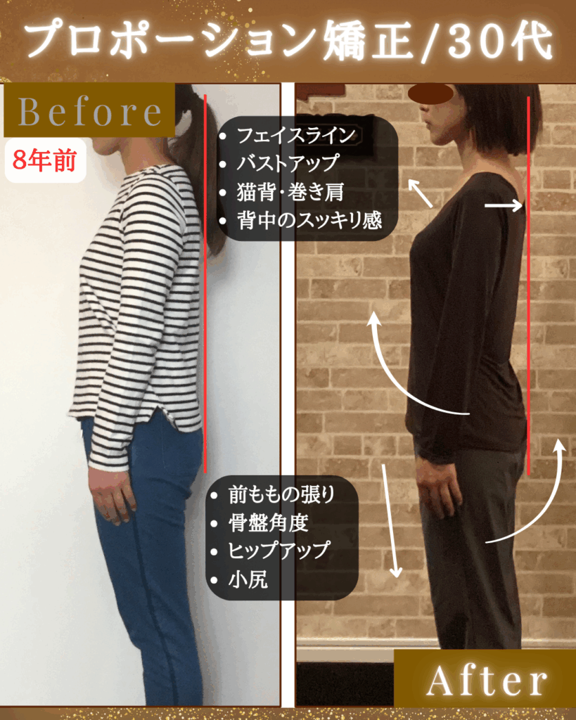 富士市整体｜富士市リバース｜富士市小顔矯正｜富士市姿勢矯正｜プロポーション矯正｜ダイエット｜８年半｜ビフォーアフター｜ブログ｜疲労回復｜即効性｜ストレートネック改善｜横向き