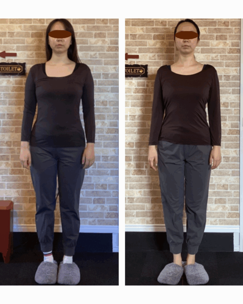 富士市リバース｜富士市整体｜富士市骨盤矯正｜富士市小顔矯正｜ビフォーアフター｜ブログ
