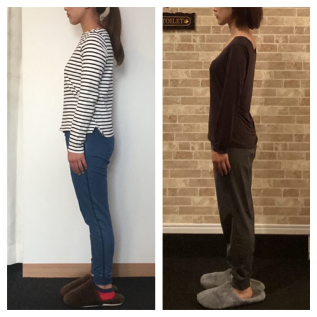 富士市整体｜富士市リバース｜富士市小顔矯正｜富士市姿勢矯正｜プロポーション矯正｜ダイエット｜８年半｜ビフォーアフター｜ブログ｜疲労回復｜即効性｜ストレートネック改善｜