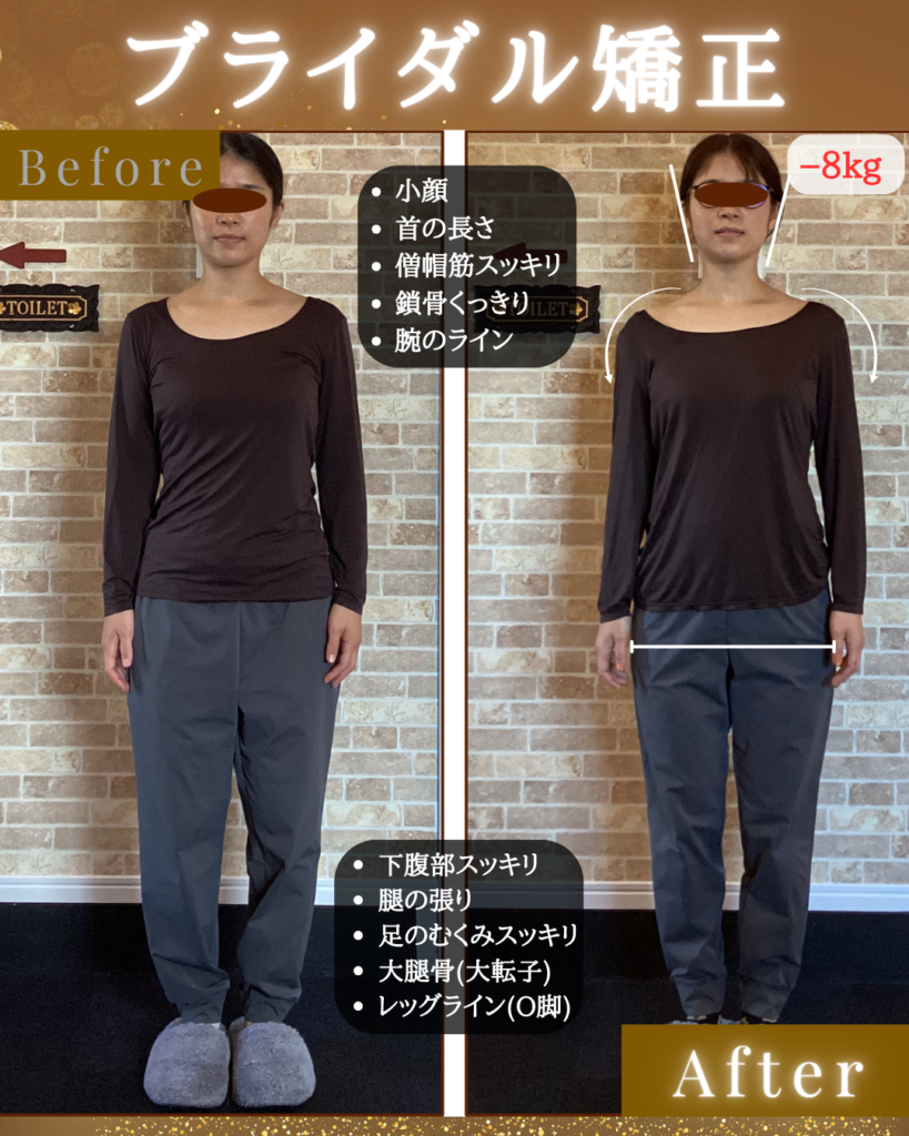 富士市整体｜美容矯正サロンリバース｜小顔矯正｜ブライダル矯正｜産後のメンテ｜−8キロを半年で｜ビフォーアフター写真正面