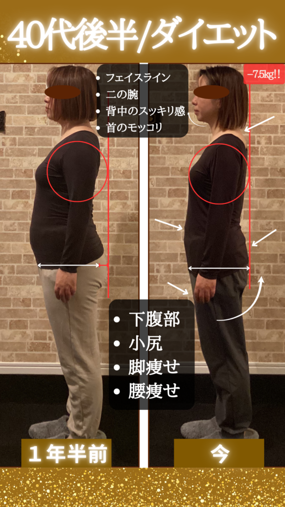 富士市整体｜美容矯正サロンリバース｜ビフォーアフターブログ｜４０代後半｜横向き