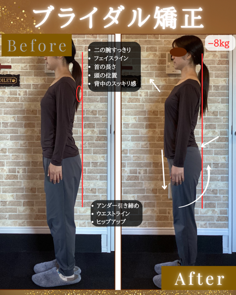 富士市整体｜美容矯正サロンリバース｜小顔矯正｜ブライダル矯正｜産後のメンテ｜−8キロを半年で｜ビフォーアフター写真横向き