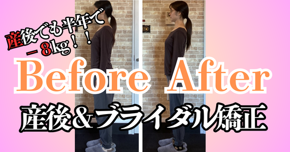 ビフォーアフター【ブライダル矯正】産後から半年で−8kg！