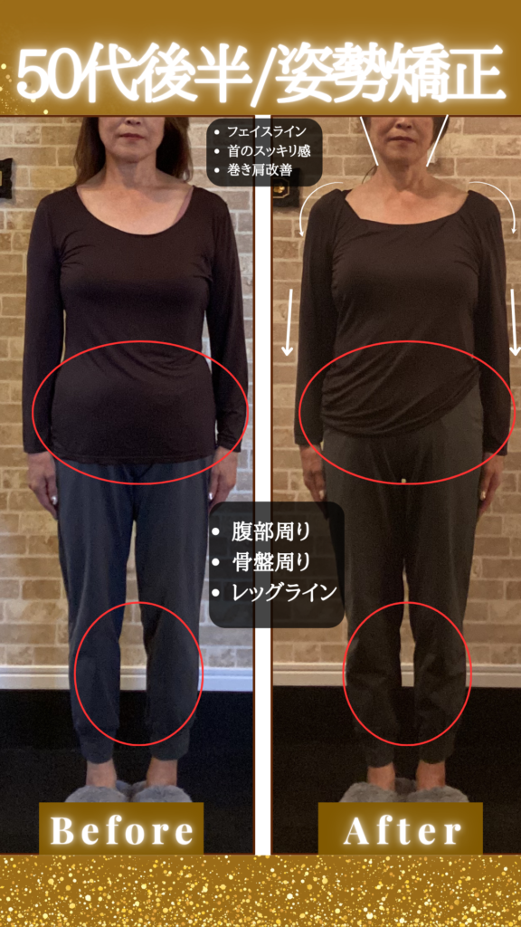 富士市で整体といえば美容矯正サロンリバース。リバースのビフォーアフター59歳の変化。正面