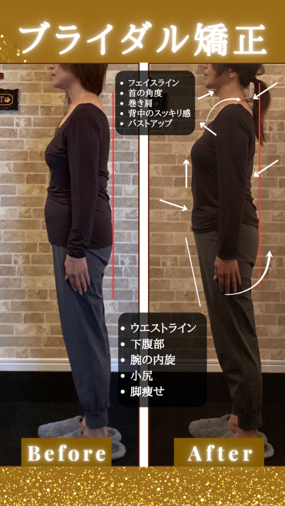 富士市で整体といえば美容矯正サロンリバース。リバースのビフォーアフター59歳の変化。横向き