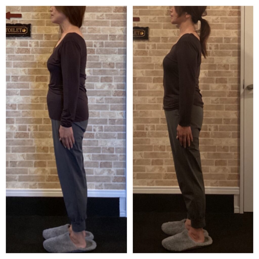 富士市の整体サロンリバースの、59歳の初回のビフォーアフター。フェイスラインや下腹部、姿勢の改善が顕著