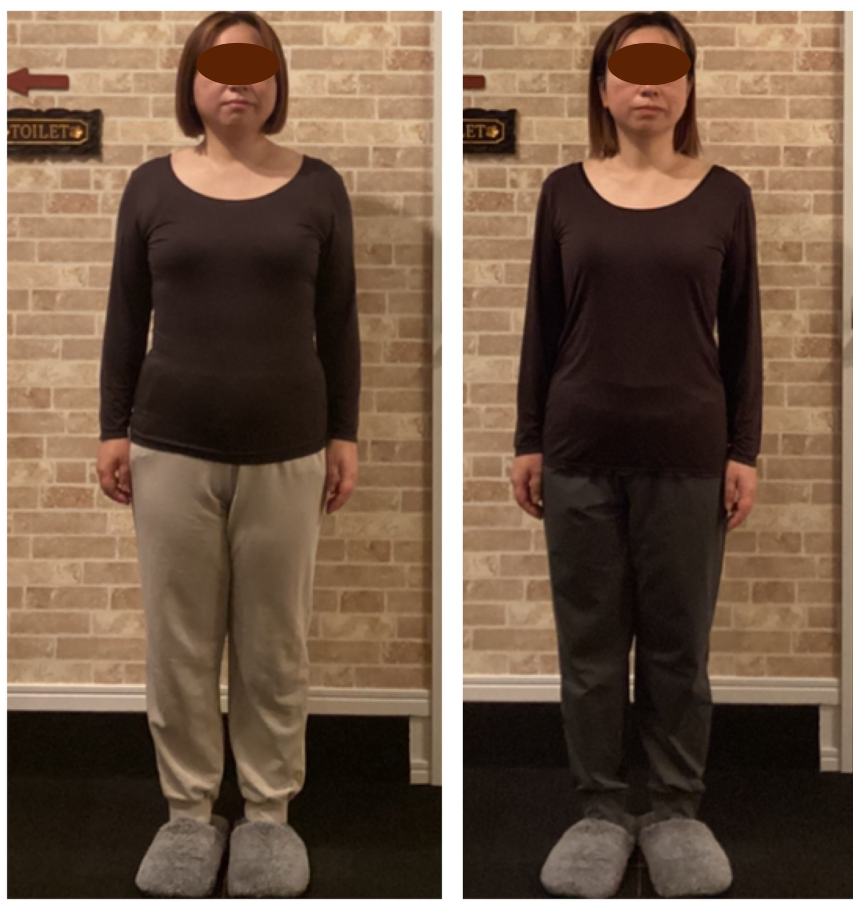 富士市の整体サロンリバースの、46歳の1年半のビフォーアフター。フェイスラインや下腹部、姿勢の改善が顕著